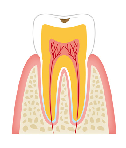 tooth1 - 一般歯科