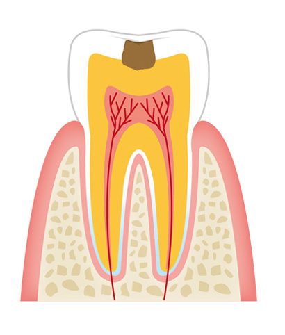 tooth2 - 一般歯科
