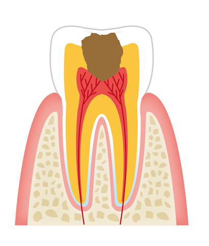 tooth3 - 一般歯科